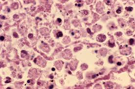 image of legionairres bacteria